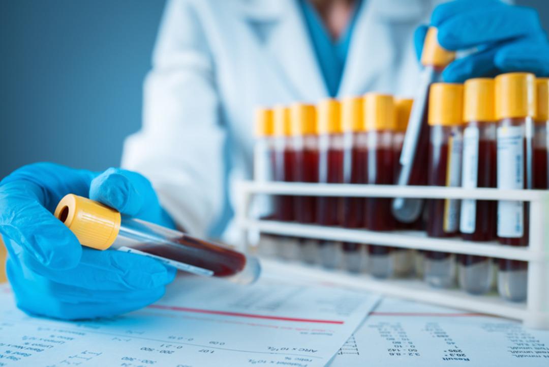 Tıp dünyasında ilk! Yeni kan grubu keşfedildi! Test olmadan uyumlu değil ... 2